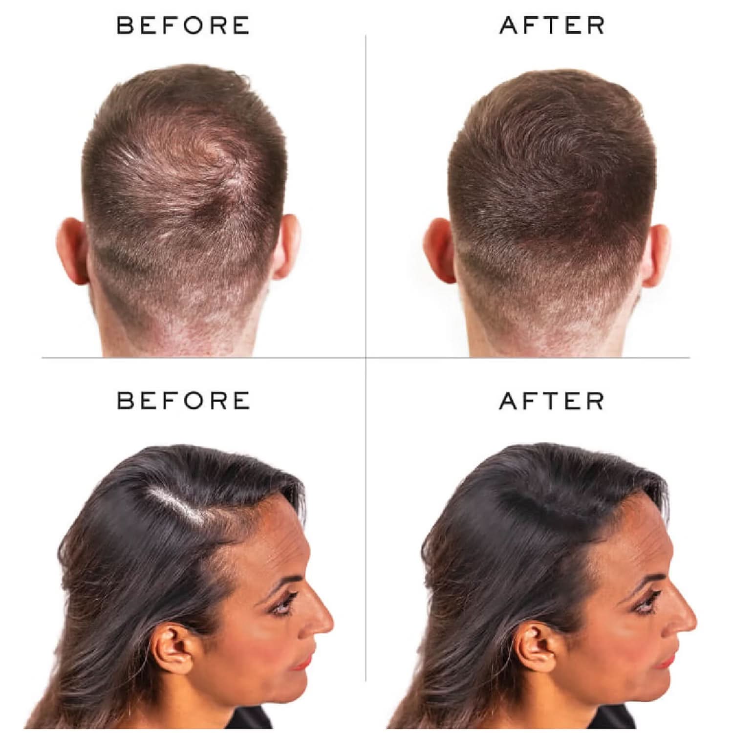 NANOGEN HAIR FIBRES (15KG)