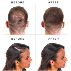 NANOGEN HAIR FIBRES (15KG)