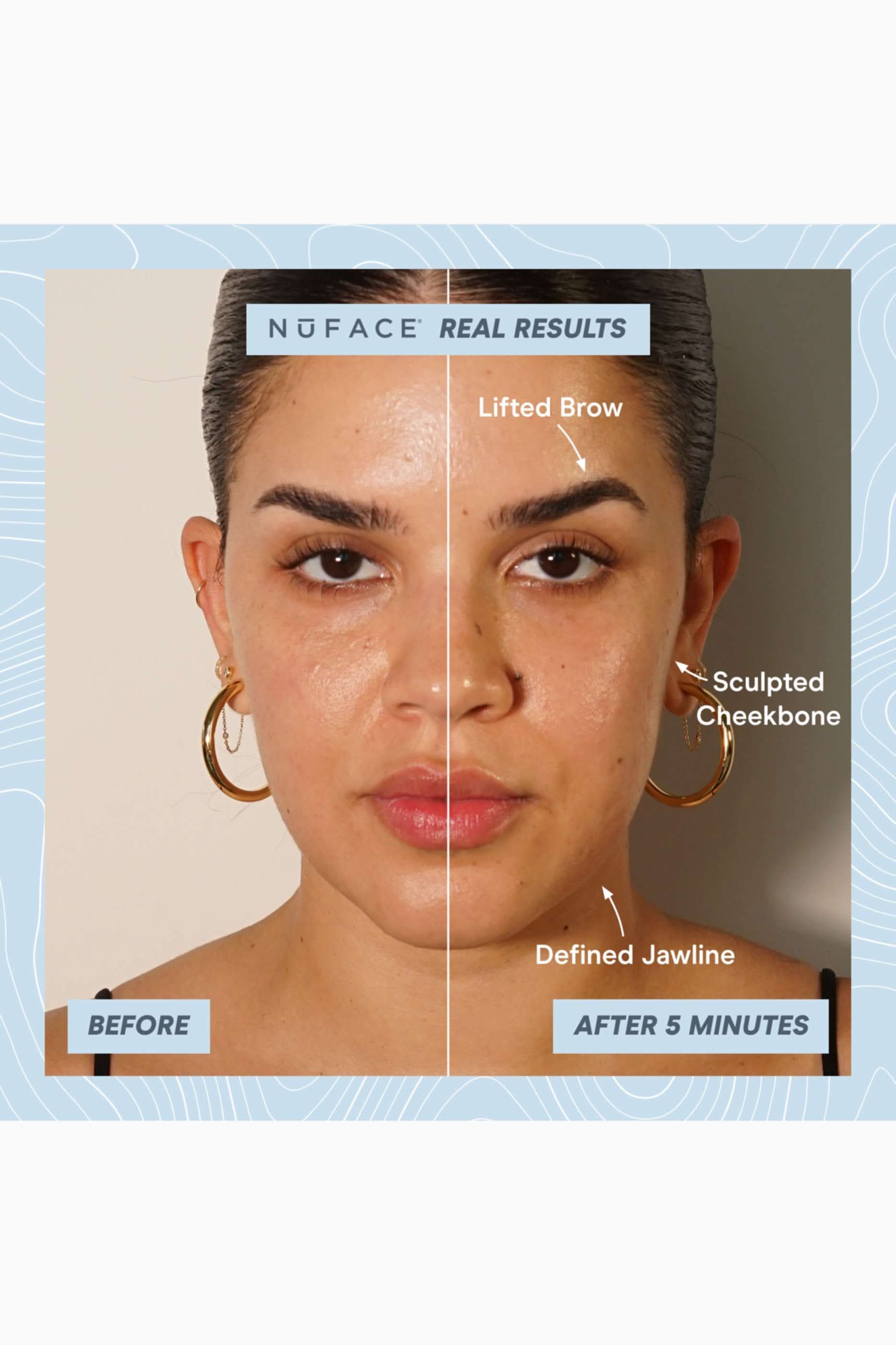 NuFACE Follow NuFaceTRINITY+ PRO Starter Kit
