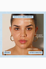 NuFACE Follow NuFaceTRINITY+ PRO Starter Kit