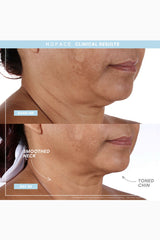 NuFACE Follow NuFaceTRINITY+ PRO Starter Kit