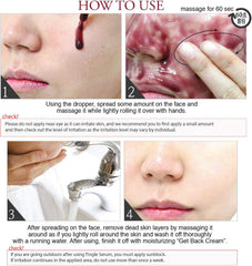 so natural - Red Peel Tingle Serum