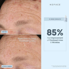 NuFACE Firming and Smoothing Super Peptide Booster Serum 30ml