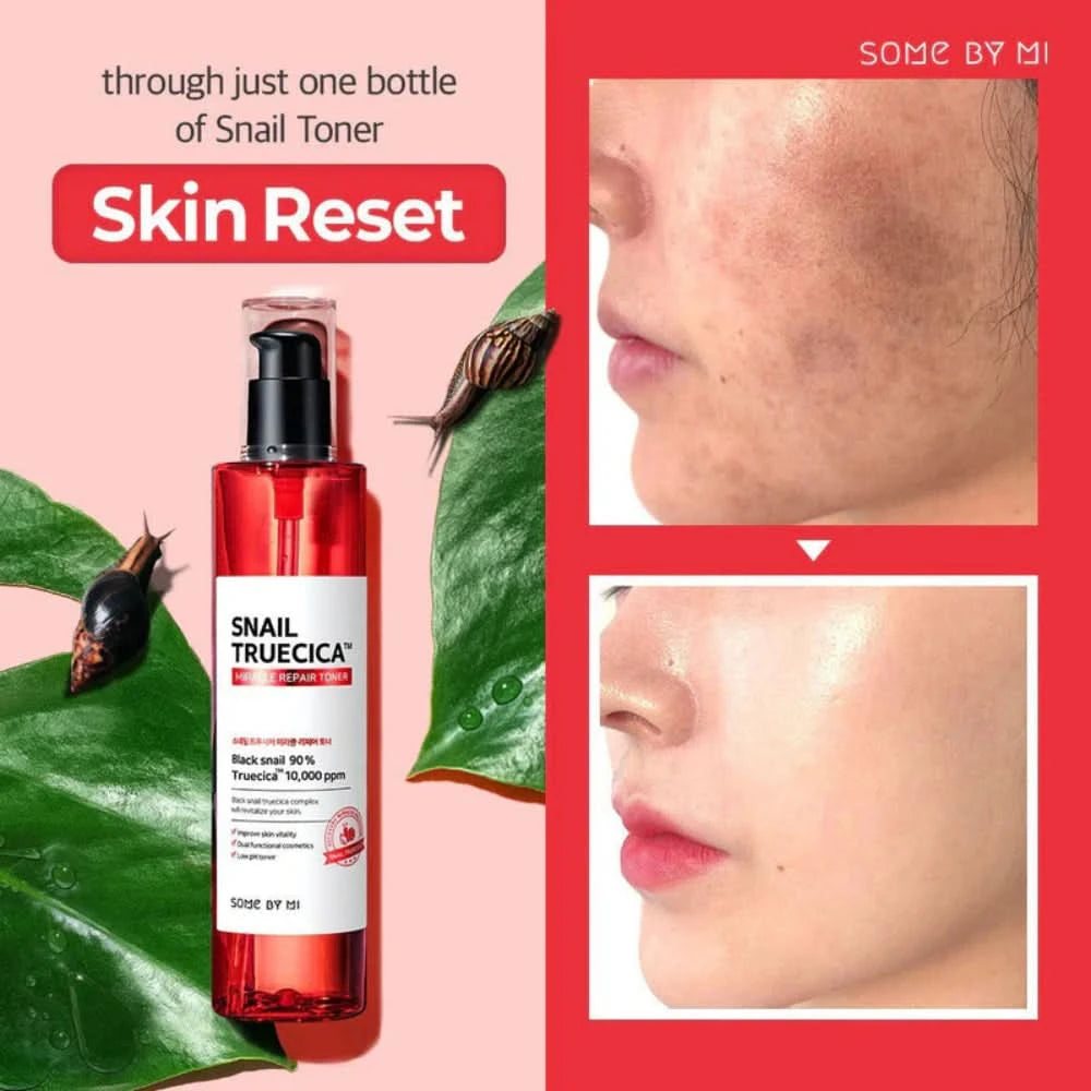 SOME BY MI - Snail Truecica Miracle Repair Toner (135ml)