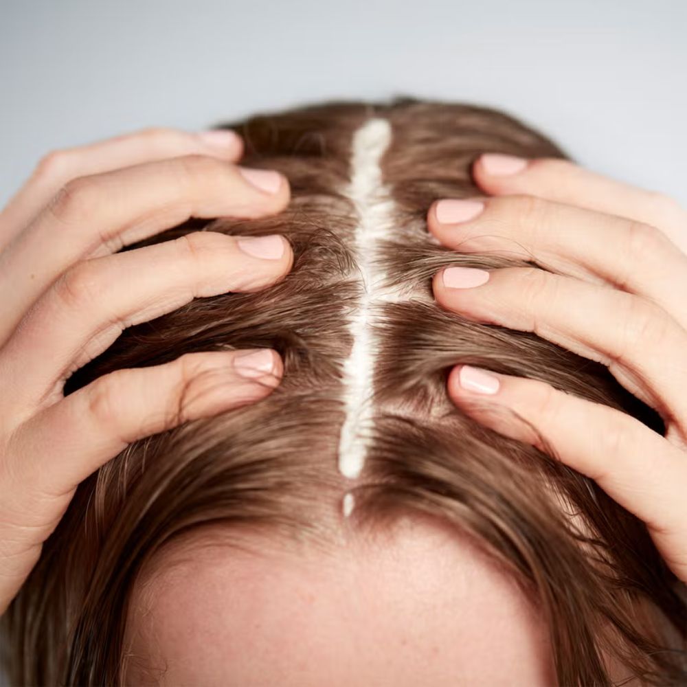 سيروم أميليوريت لتجديد فروة الرأس 125 مل