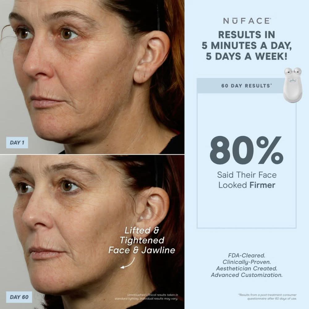 NuFACE® Mini Starter Kit