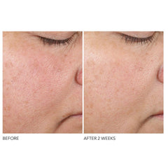 Dr. Dennis Gross Skincare Advanced Retinol and Ferulic Texture Renewal Serum