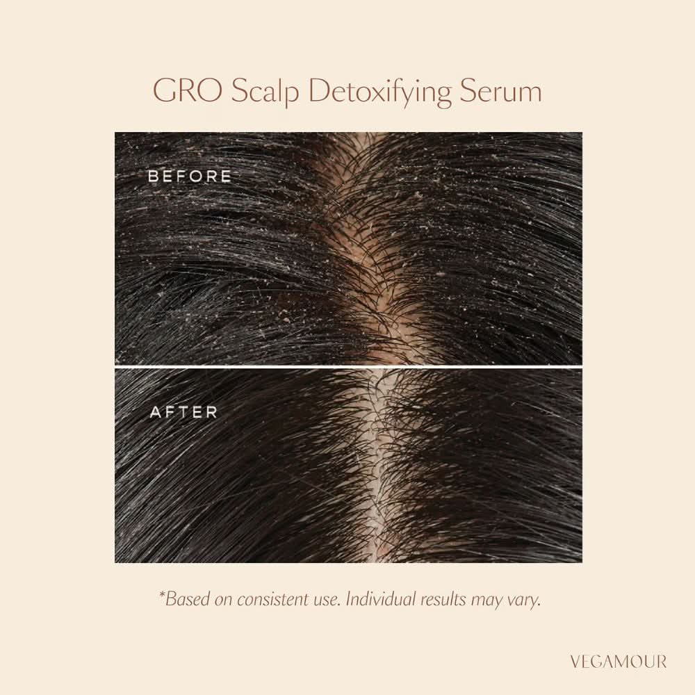 VEGAMOUR GRO Scalp Detox Clarifying Treatment for Dry, Flaky, Oily Scalp