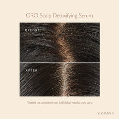 VEGAMOUR GRO Scalp Detox Clarifying Treatment for Dry, Flaky, Oily Scalp