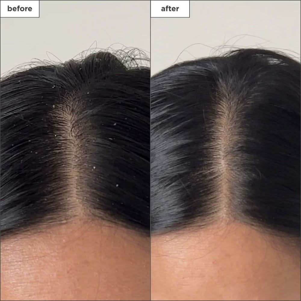 بخاخ BRIOGEO Scalp Revival™ لإزالة تراكمات السموم بالفحم وشجرة الشاي