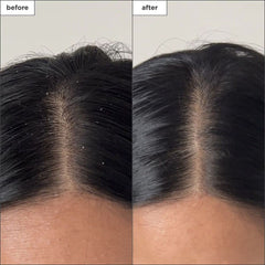 BRIOGEO Scalp Revivalβ’ Charcoal + Tea Tree Buildup Detox Spray
