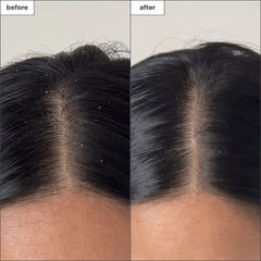 بخاخ BRIOGEO Scalp Revival™ لإزالة تراكمات السموم بالفحم وشجرة الشاي