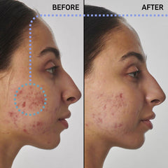 THE INKEY LIST SuperSolutionsᐩ 1% Retinol Serum