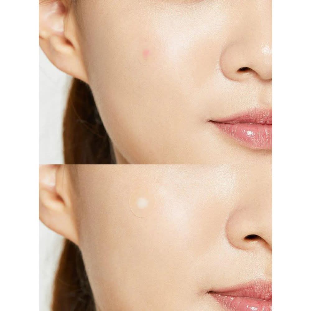 COSRX - Acne Pimple Master Patch