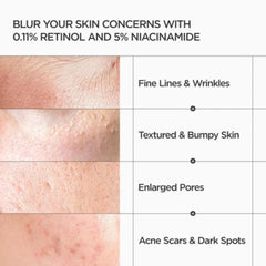 Anua - Retinol 0.3% + Niacin Renewing Serum 30ml