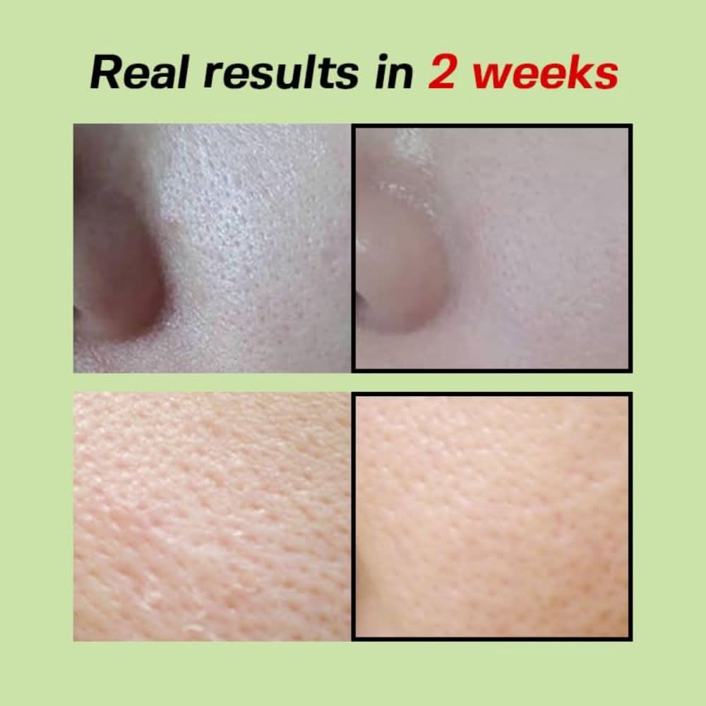 SUNGBOON EDITOR - Green Tomato Pore Lifting Ampoule+