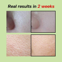 SUNGBOON EDITOR - Green Tomato Pore Lifting Ampoule+