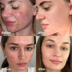 Medicube - Red Succinic Acid Serum