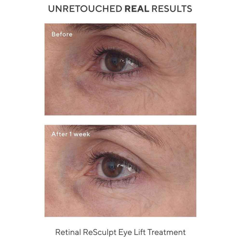 علاج موراد ريتينال ريسكولبت للعين 15 مل