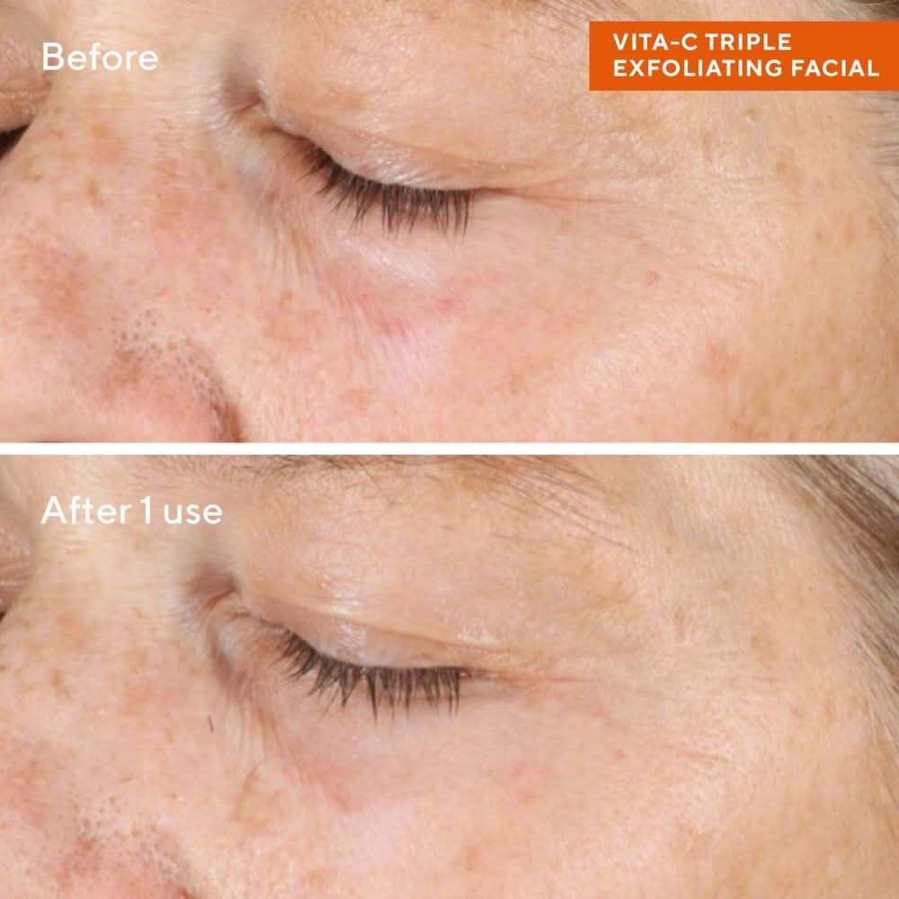 Murad Vita-C Triple Exfoliating Facial