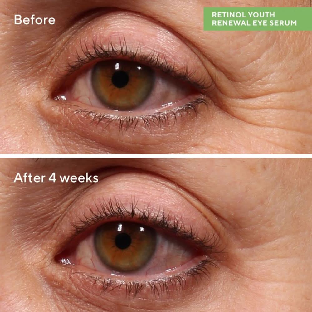 Murad Rapid Wrinkle Repair Set