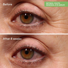 Murad Rapid Wrinkle Repair Set