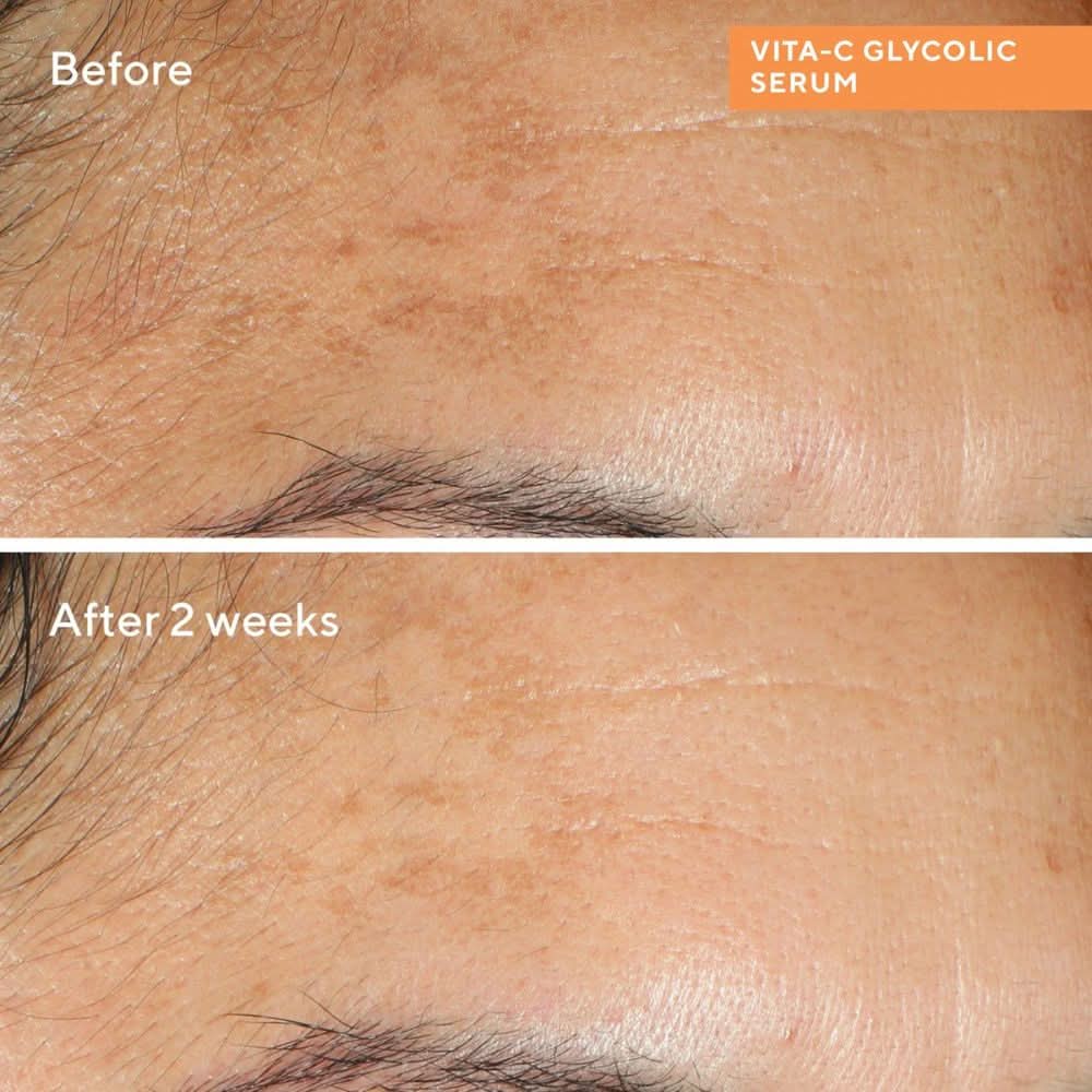 Murad Vitamin C Starter Kit