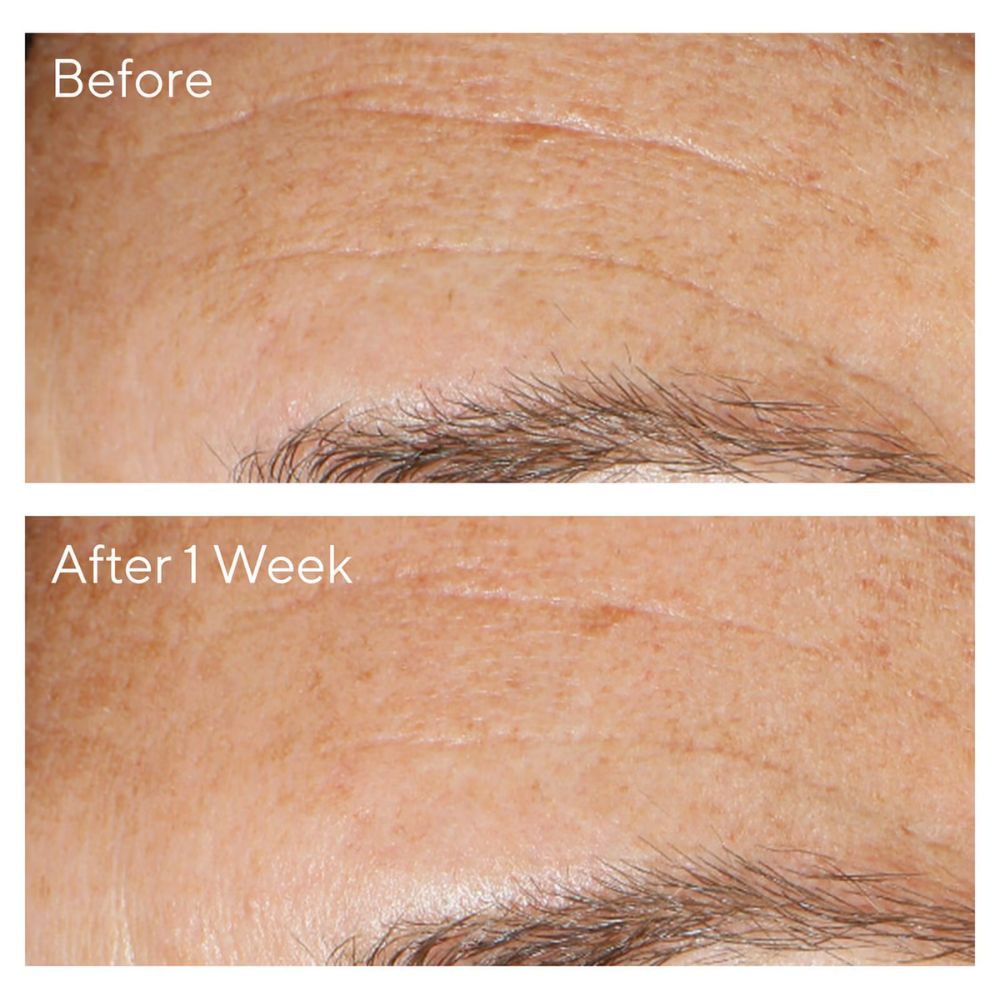 مقشر مراد متعدد الأحماض المجدد 100 مل