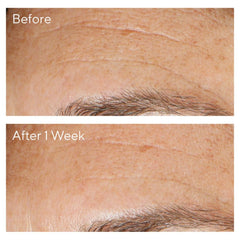 مقشر مراد متعدد الأحماض المجدد 100 مل