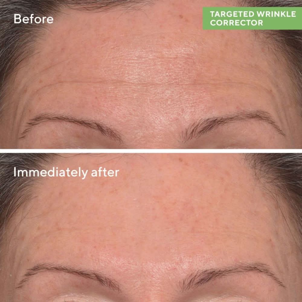 Murad Targeted Wrinkle Corrector 15ml