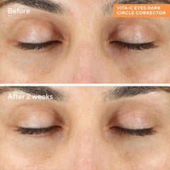 مراد فيتا-سي مصحح الهالات السوداء للعينين 15 مل