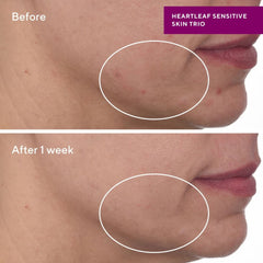 غسول مراد المهدئ للبشرة الحساسة بخلاصة أوراق القلب 148 مل