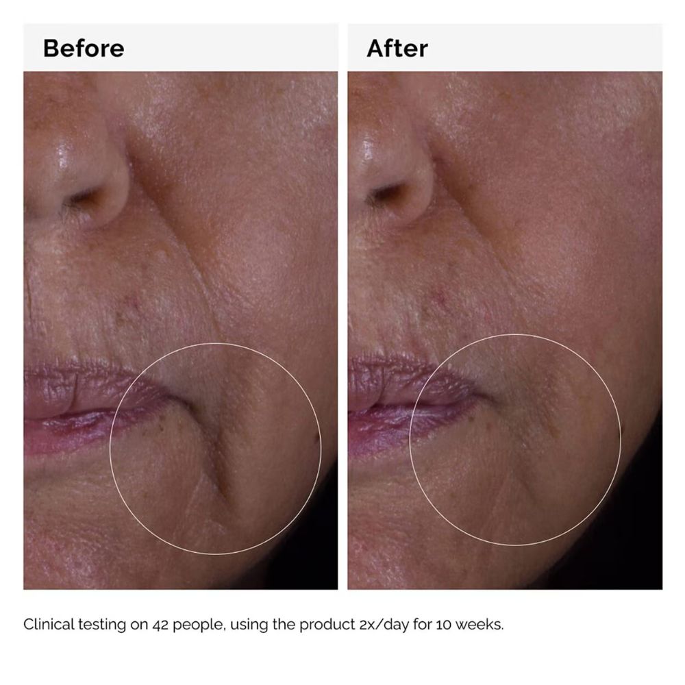 THE ORDINARY GF Solution 15% Serum