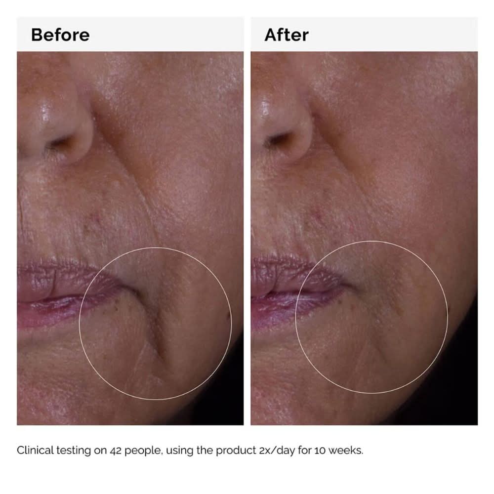 THE ORDINARY GF Solution 15% Serum