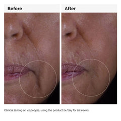 THE ORDINARY GF Solution 15% Serum