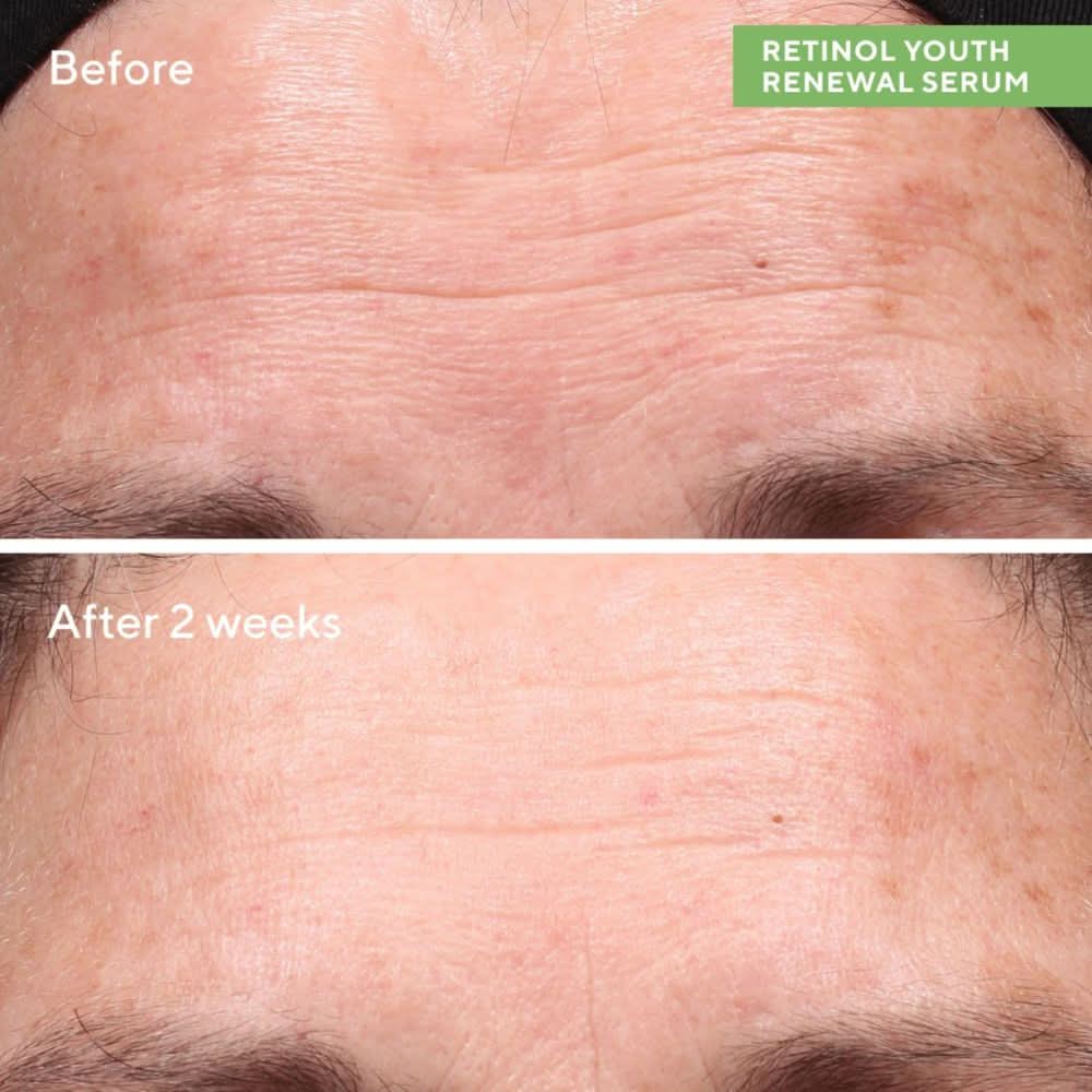 Murad Retinol Starter Kit