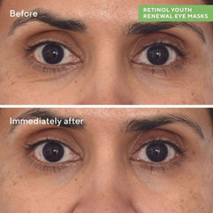 أقنعة العين مراد ريتينول لتجديد شباب البشرة (عبوة من 5 أقنعة)