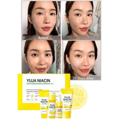 SOME BY MI - Yuja Niacin 30 Days Brightening Starter Kit