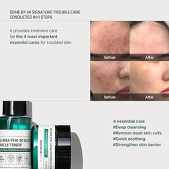 مجموعة محدودة من منتجات SOME BY MI - AHA، BHA، PHA، مجموعة بداية معجزة لمدة 30 يومًا