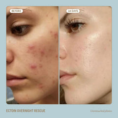 Biossance Squalane and Ectoin Overnight Rescue 50ml