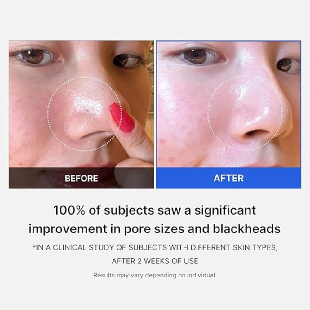 Medicube - Zero Pore Pad 2.0