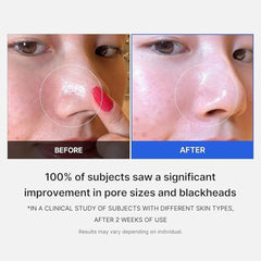 Medicube - Zero Pore Pad 2.0