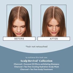 BRIOGEO Scalp Revivalβ’ Charcoal + Tea Tree Scalp Treatment Serum