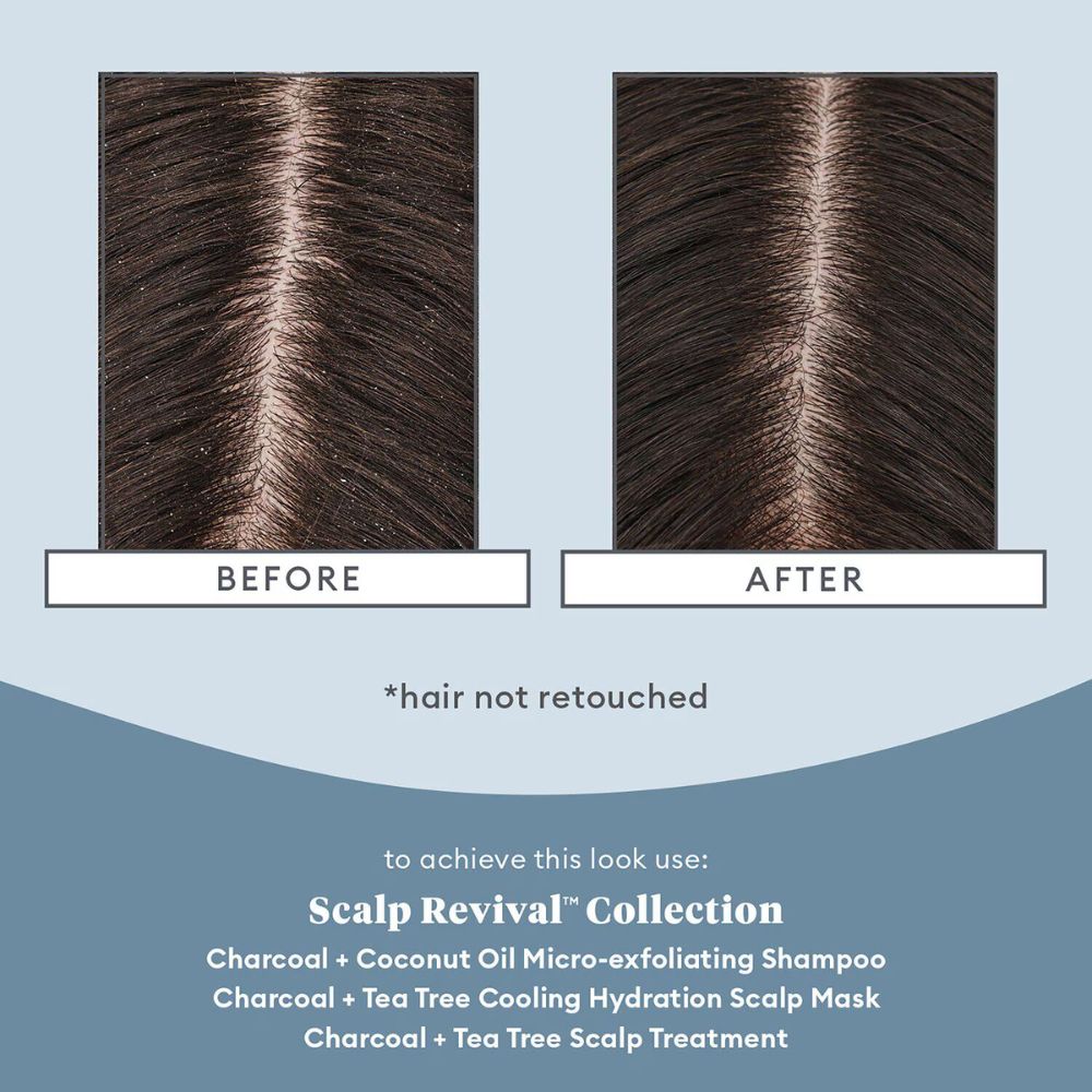 BRIOGEO Scalp Revivalβ’ Soothe + Detoxify Travel Set