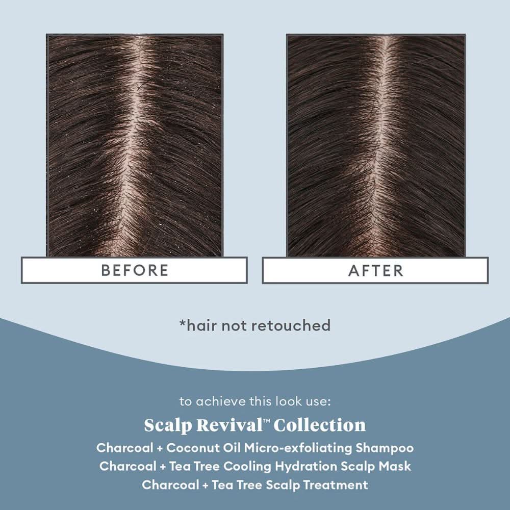 مجموعة السفر BRIOGEO Scalp Revival™ لتهدئة فروة الرأس وإزالة السموم