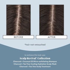 مجموعة السفر BRIOGEO Scalp Revival™ لتهدئة فروة الرأس وإزالة السموم