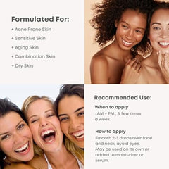 NINELESS - A-Control 10% Azelaic Acid Serum