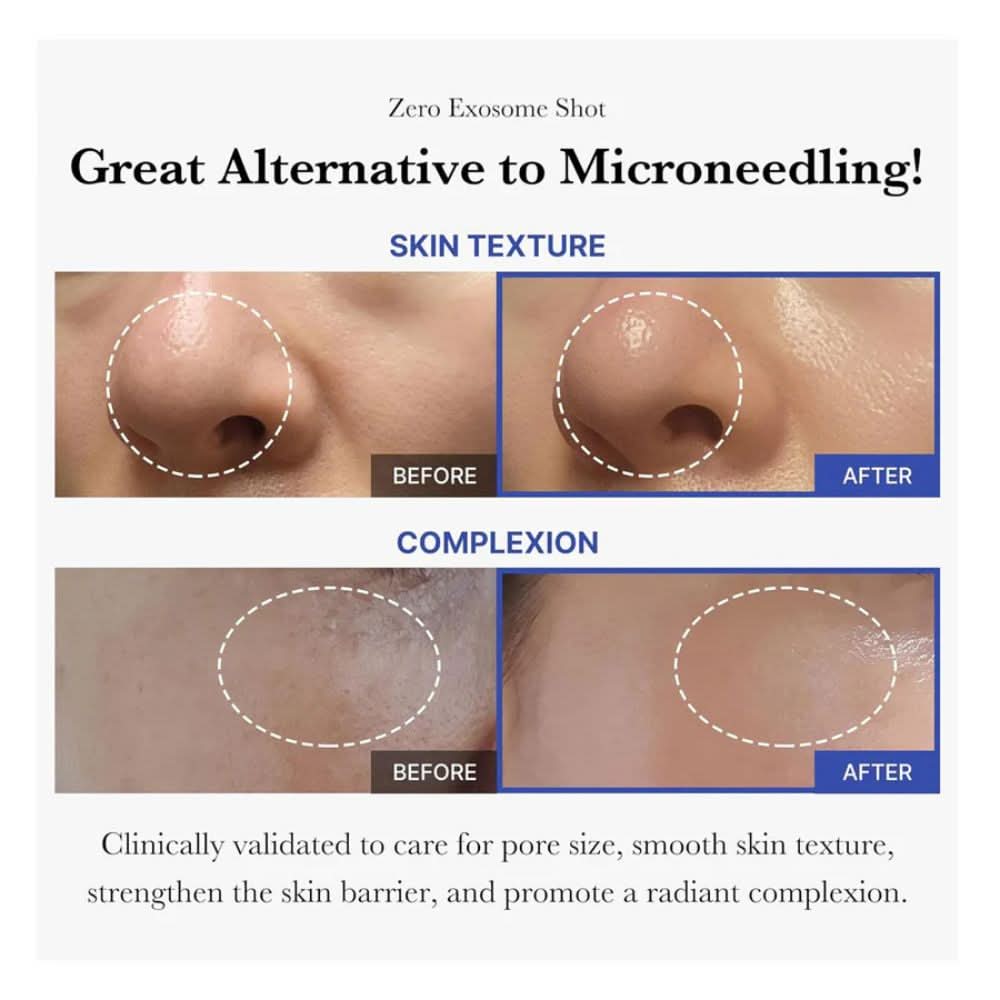 Medicube - One Day Exosome Shot Pore Ampoule 2000