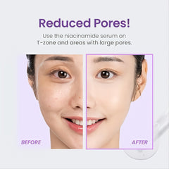 TIRTIR - Niacinamide 20% Serum