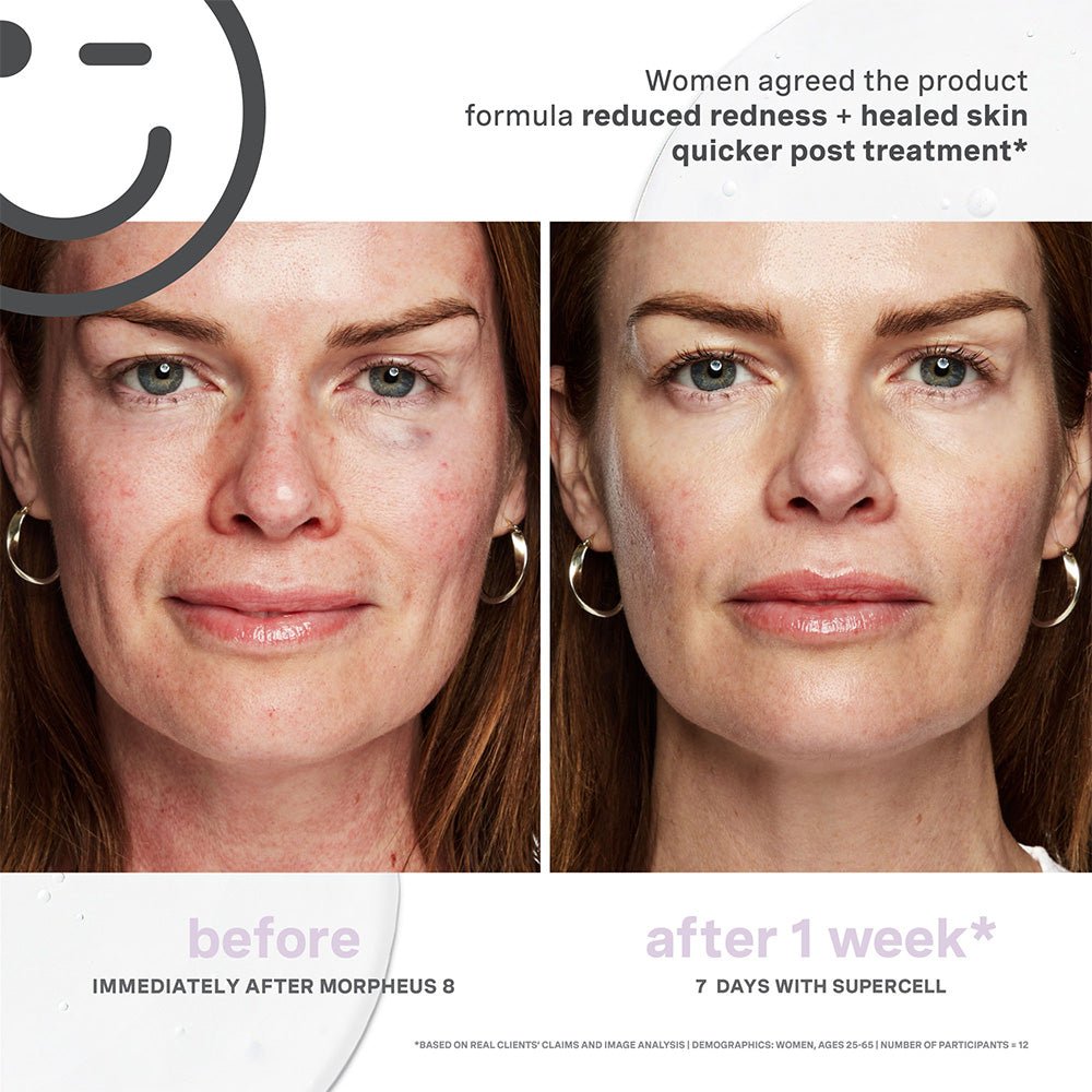Kate Somerville Kateceuticals Supercell Rejuvenation Serum - 1oz/30